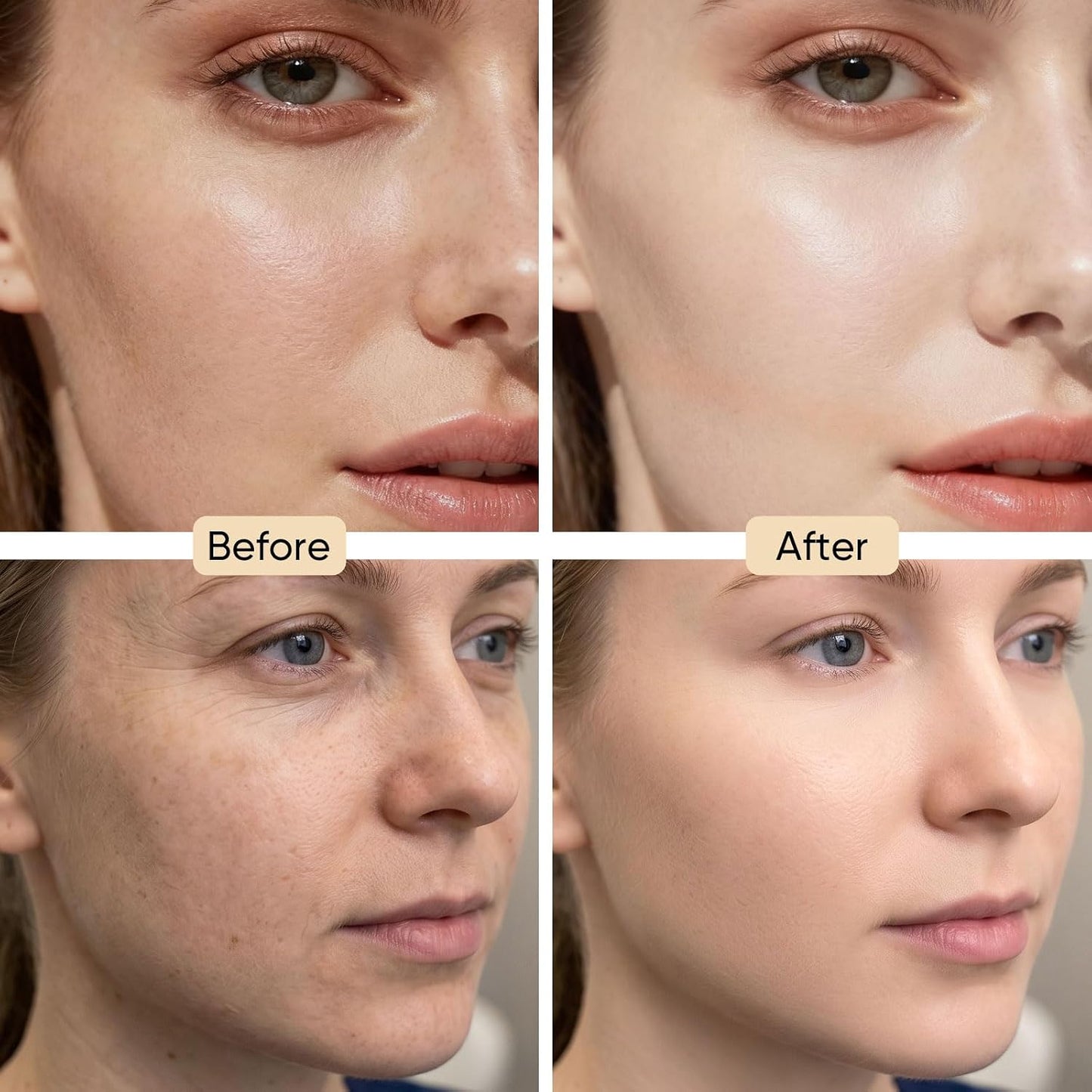 Snail Mucin Serum 100Ml, Hydrating Serum for Face with Snail Secretion | Advanced Snail 96% Mucin Power Essence for Dull Skin, Repairing Moisturizing Skin Care for Women
