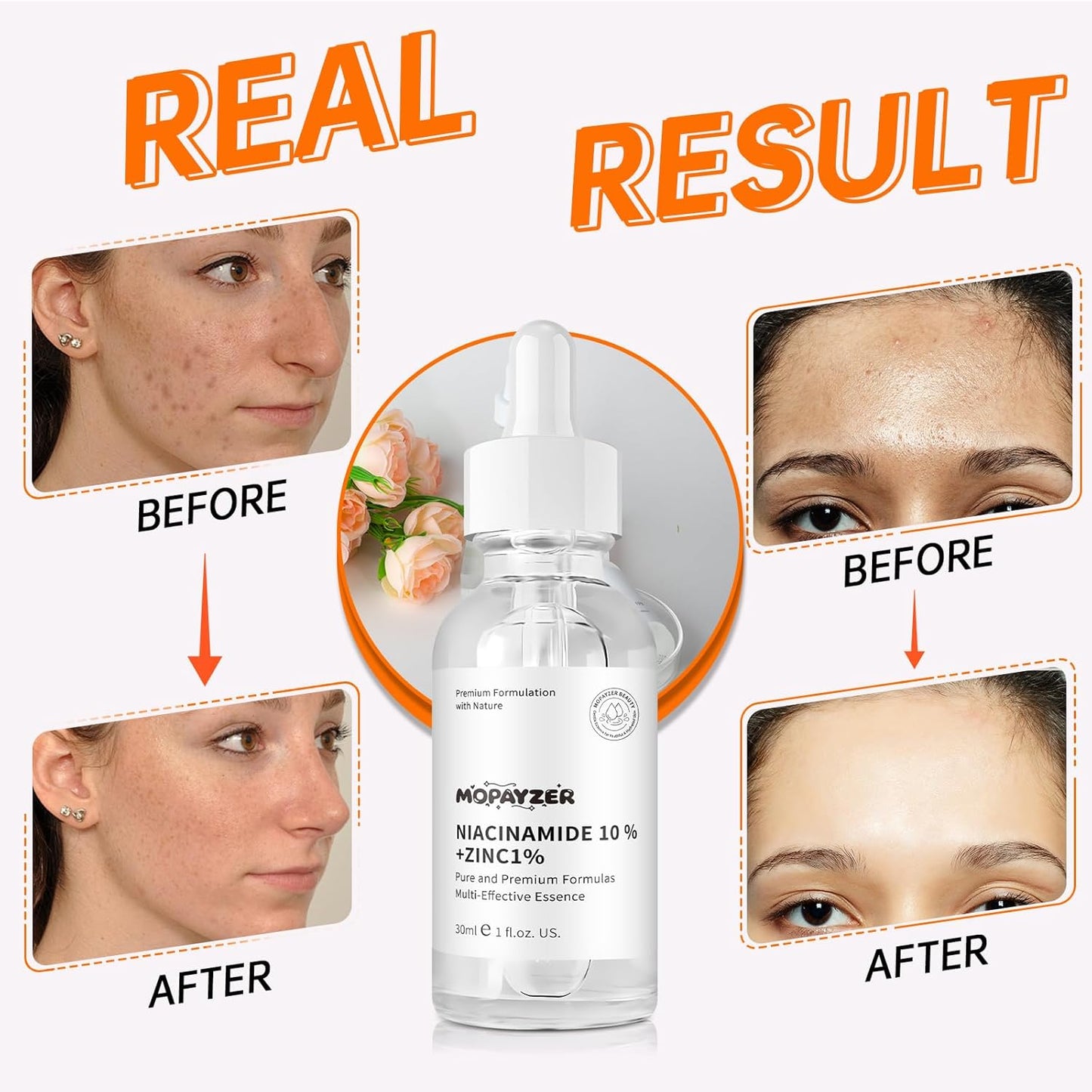 Niacinamide 10% + Zinc 1% Serum, Anti-Aging Niacinamide Serum for Face, 1PCS Moisturizing Facial Serum for All Skin Type, Women Face Skin Care.